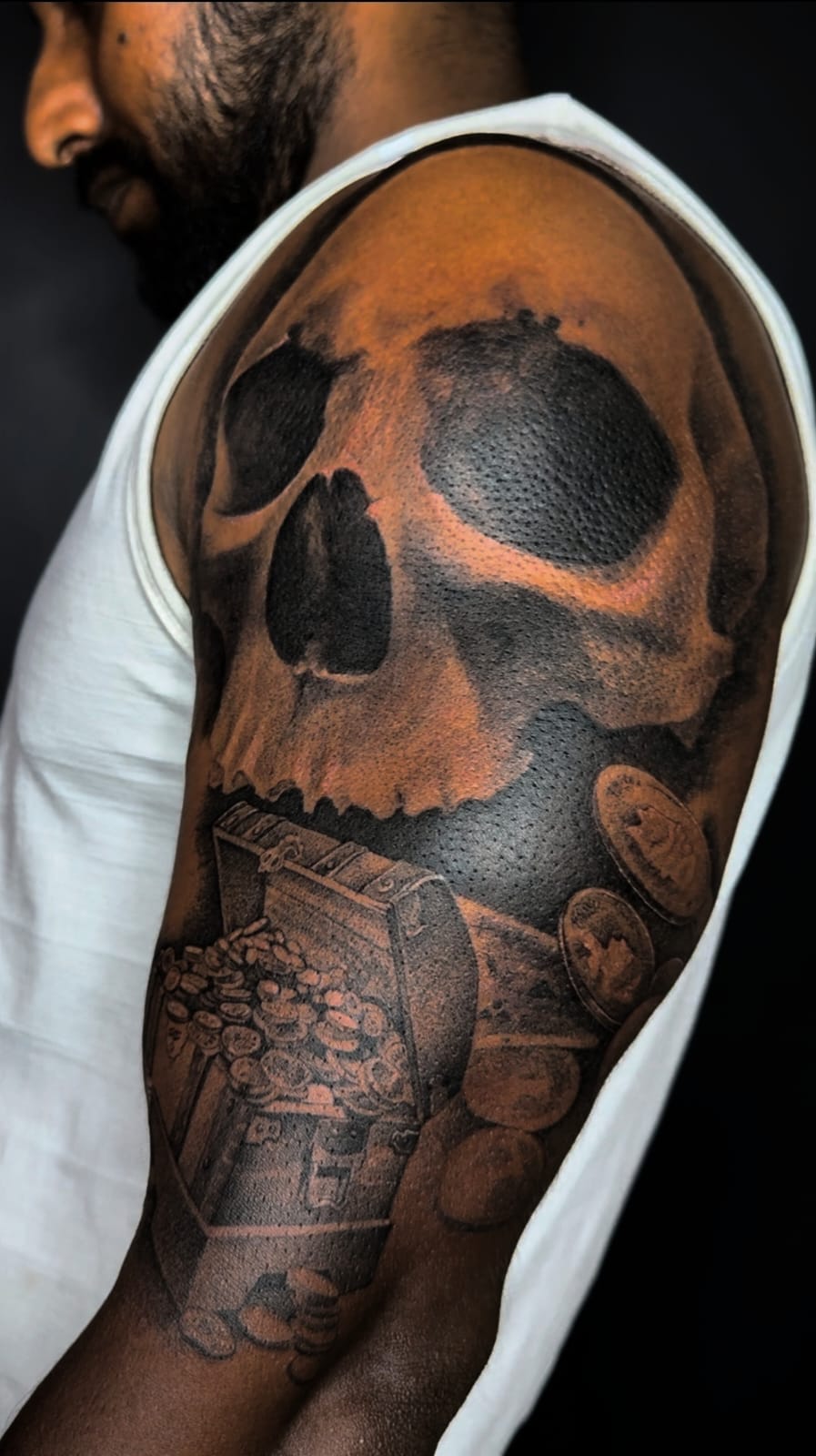 Big brown shoulder